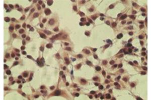 ICC staining of HeLa cell using control (rabbit Ig) at 5 ug/mL . (CYLD anticorps  (AA 32-45))