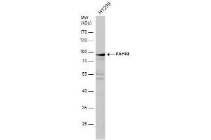 WB Image PAF49 antibody detects PAF49 protein by western blot analysis. (CD3EAP anticorps  (Center))