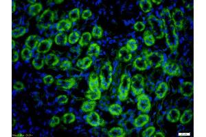 Formalin-fixed and paraffin embedded rat kidney labeled with Rabbit Anti-Hepsin Polyclonal Antibody, Unconjugated (ABIN716816) at 1:200 followed by conjugation to the secondary antibody Goat Anti-Rabbit IgG, FITC conjugated used at 1:200 dilution for 40 minutes at 37°C.