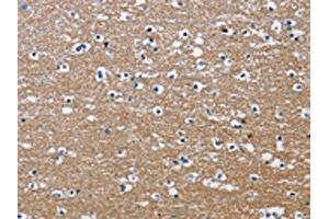 The image on the left is immunohistochemistry of paraffin-embedded Human brain tissue using ABIN7130690(PPP3CA Antibody) at dilution 1/30, on the right is treated with fusion protein. (PPP3CA anticorps)