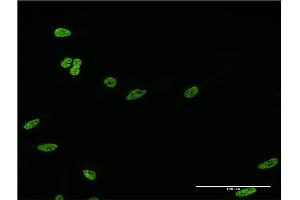 Immunofluorescence of monoclonal antibody to HOXC12 on HeLa cell.