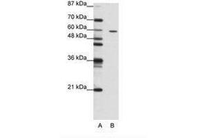 Image no. 1 for anti-Zinc Finger Protein 382 (ZNF382) (N-Term) antibody (ABIN202748) (ZNF382 anticorps  (N-Term))