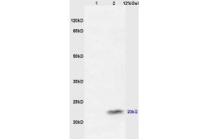 Lane 1: mouse intestine lysates Lane 2: mouse testis lysates probed with Anti GRM1 Polyclonal Antibody, Unconjugated (ABIN721135) at 1:200 in 4 °C.