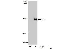 IP Image Immunoprecipitation of MYH9 protein from HeLa whole cell extracts using 5 μg of MYH9 antibody [N1], N-term, Western blot analysis was performed using MYH9 antibody [N1], N-term, EasyBlot anti-Rabbit IgG  was used as a secondary reagent. (Myosin 9 anticorps  (N-Term))