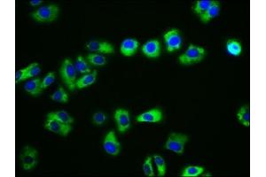 Immunofluorescence staining of HepG2 cells with ABIN7146213 at 1:133, counter-stained with DAPI. (CDH15 anticorps  (AA 639-766))