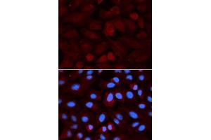Immunofluorescence analysis of U2OS cells using ALDH3A1 antibody. (ALDH3A1 anticorps  (AA 1-300))