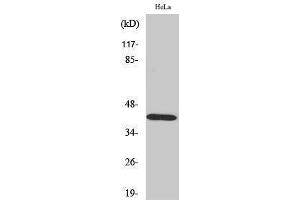 Western Blotting (WB) image for anti-serpin Peptidase Inhibitor, Clade B (Ovalbumin), Member 5 (SERPINB5) (Internal Region) antibody (ABIN3180164) (SERPINB5 anticorps  (Internal Region))