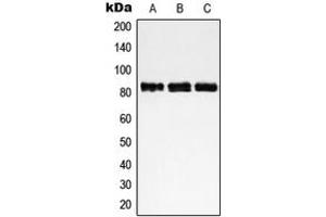 Western blot analysis of NCAPH expression in HeLa (A), Jurkat (B), MOLT4 (C) whole cell lysates. (NCAPH anticorps  (Center))