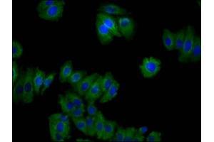 Immunofluorescence staining of HepG2 cells with ABIN7159453 at 1:100, counter-stained with DAPI. (Cyclin M2 anticorps  (AA 739-875))