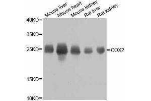 Western blot analysis of extracts of various cell lines, using MT-CO2 antibody.