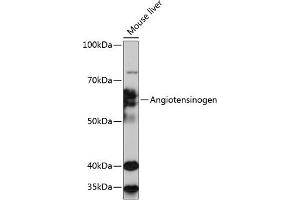 Western blot analysis of extracts of Mouse liver, using Angiotensinogen Rabbit mAb (ABIN7265598) at 1:1000 dilution. (AGT anticorps)