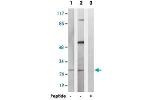 Western blot analysis of extracts from K-562 cells and COS-7 cells, using MARCH3 polyclonal antibody . (MARCH3 anticorps)