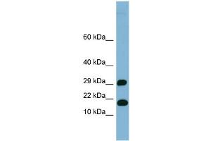 WB Suggested Anti-TRAPPC2L Antibody Titration: 0. (TRAPPC2L anticorps  (N-Term))