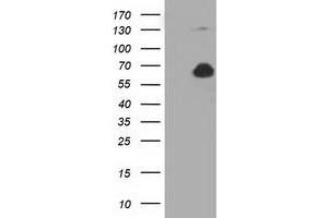 Western Blotting (WB) image for anti-Pyruvate Kinase, Liver and RBC (PKLR) antibody (ABIN1500246) (PKLR anticorps)