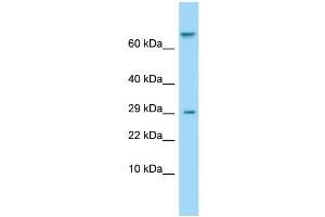 Host: Rabbit Target Name: TAS1R1 Sample Type: ACHN Whole Cell lysates Antibody Dilution: 1.