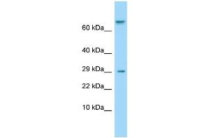 Host: Rabbit Target Name: TAS1R1 Sample Type: ACHN Whole Cell lysates Antibody Dilution: 1. (TAS1R1 anticorps  (Middle Region))