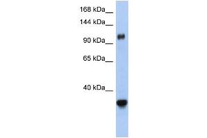 WB Suggested Anti-XPO5 Antibody Titration:  0. (XPO5 anticorps  (Middle Region))
