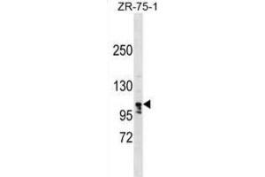 Western Blotting (WB) image for anti-La Ribonucleoprotein Domain Family, Member 1B (LARP1B) antibody (ABIN2999647) (LARP1B anticorps)