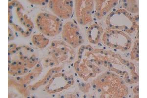 DAB staining on IHC-P; Samples: Human Kidney Tissue