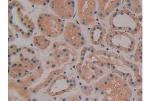 DAB staining on IHC-P; Samples: Human Kidney Tissue (TFPI anticorps  (AA 29-304))