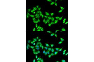 Immunofluorescence analysis of U20S cell using KIF3A antibody. (KIF3A anticorps)