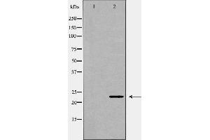 Western blot analysis of lung1  lysate using FGF10 antibody. (FGF10 anticorps  (C-Term))