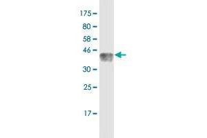 Western Blot detection against Immunogen (36. (TCF7 anticorps  (AA 287-384))