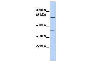 WB Suggested Anti-GBAS Antibody Titration:  0. (GBAS anticorps  (Middle Region))