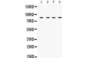 Western Blotting (WB) image for anti-Transforming Growth Factor, beta Receptor II (70/80kDa) (TGFBR2) (AA 96-128), (N-Term) antibody (ABIN3043311) (TGFBR2 anticorps  (N-Term))