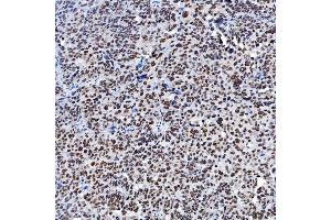 IHC analysis of SF3A1 using anti-SF3A1 antibody (ABIN7600556). (SF3A1 anticorps  (AA 20-556))