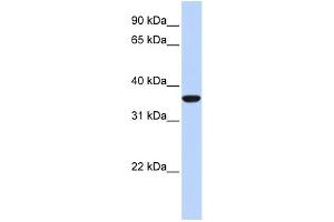 WB Suggested Anti-MAFB Antibody Titration: 0. (MAFB anticorps  (N-Term))