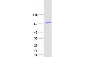Validation with Western Blot