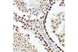 Immunohistochemistry of paraffin-embedded mouse testis using SOX4 antibody (ABIN7270575) at dilution of 1:150 (40x lens).
