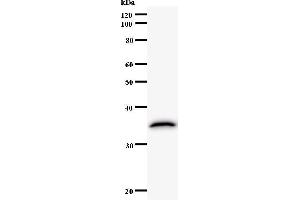 Western Blotting (WB) image for anti-Activating Transcription Factor 3 (ATF3) antibody (ABIN5676162) (ATF3 anticorps)