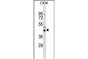 Western blot analysis in CEM cell line lysates (35ug/lane). (Zinc Finger and SCAN Domain Containing 9 (ZSCAN9) (AA 217-243) anticorps)