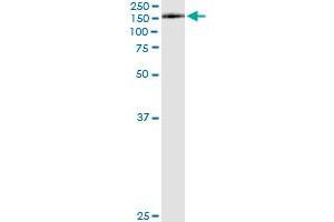 Immunoprecipitation of KIAA1199 transfected lysate using anti-KIAA1199 monoclonal antibody and Protein A Magnetic Bead , and immunoblotted with KIAA1199 MaxPab rabbit polyclonal antibody.