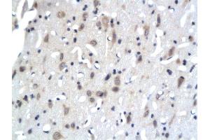 Formalin-fixed and paraffin embedded rat brain tissue labeled with Anti-PKC epsilon Polyclonal Antibody, Unconjugated  followed by conjugation to the secondary antibody (PKC epsilon anticorps  (AA 631-737))