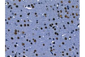 ABIN6263700 and ABIN6266787 at 1/100 staining Rat brain tissue by IHC-P. (NPM1 anticorps  (N-Term))