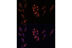 Immunofluorescence analysis of HeLa cells using PDE3A Polyclonal Antibody (ABIN7269301) at dilution of 1:100 (40x lens).