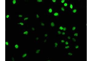Immunofluorescence staining of U251 cells with ABIN7164153 at 1:166, counter-stained with DAPI. (PRPF39 anticorps  (AA 41-190))
