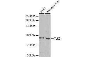 Western blot analysis of extracts of various cell lines, using TLK2 antibody (ABIN2560433) at 1:1000 dilution. (TLK2 anticorps)