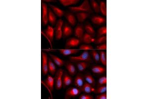 Immunofluorescence analysis of U2OS cells using PSMA5 antibody. (PSMA5 anticorps  (AA 1-241))