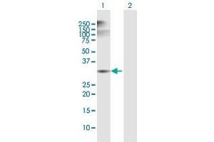 Western Blot analysis of ANXA5 expression in transfected 293T cell line by ANXA5 MaxPab polyclonal antibody. (Annexin V anticorps  (AA 1-320))