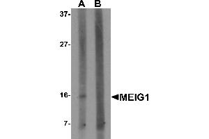 Western blot analysis of MEIG1 in human kidney tissue lysate with MEIG1 antibody at 1 µg/mL in (A) the absence and (B) the presence of blocking peptide.