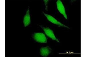 Immunofluorescence of purified MaxPab antibody to DHFR on HeLa cell.
