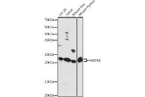 Western blot analysis of extracts of various cell lines, using MED18 antibody (ABIN7268439) at 1:1000 dilution. (MED18 anticorps  (AA 30-110))