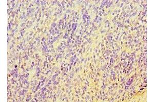 Immunohistochemistry of paraffin-embedded human tonsil tissue using ABIN7171737 at dilution of 1:100 (RAP1 anticorps  (AA 1-280))