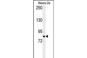 Western blot analysis of CQ028 Antibody in Neuro-2a cell line lysates (35ug/lane) (HID1/DMC1 anticorps  (C-Term))