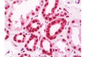 anti-AT Rich Interactive Domain 1B (SWI1-Like) (ARID1B) (AA 1364-1461) antibody