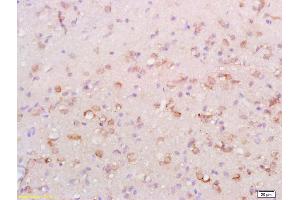 Formalin-fixed and paraffin embedded rat brain labeled with Anti-ATG1/ULK1 Polyclonal Antibody, Unconjugated (ABIN701440) at 1:200 followed by conjugation to the secondary antibody and DAB staining. (ULK1 anticorps  (AA 951-1050))